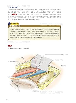 膀胱全摘除術と新膀胱造設術−Studer変法を究める [DVD付] | 望